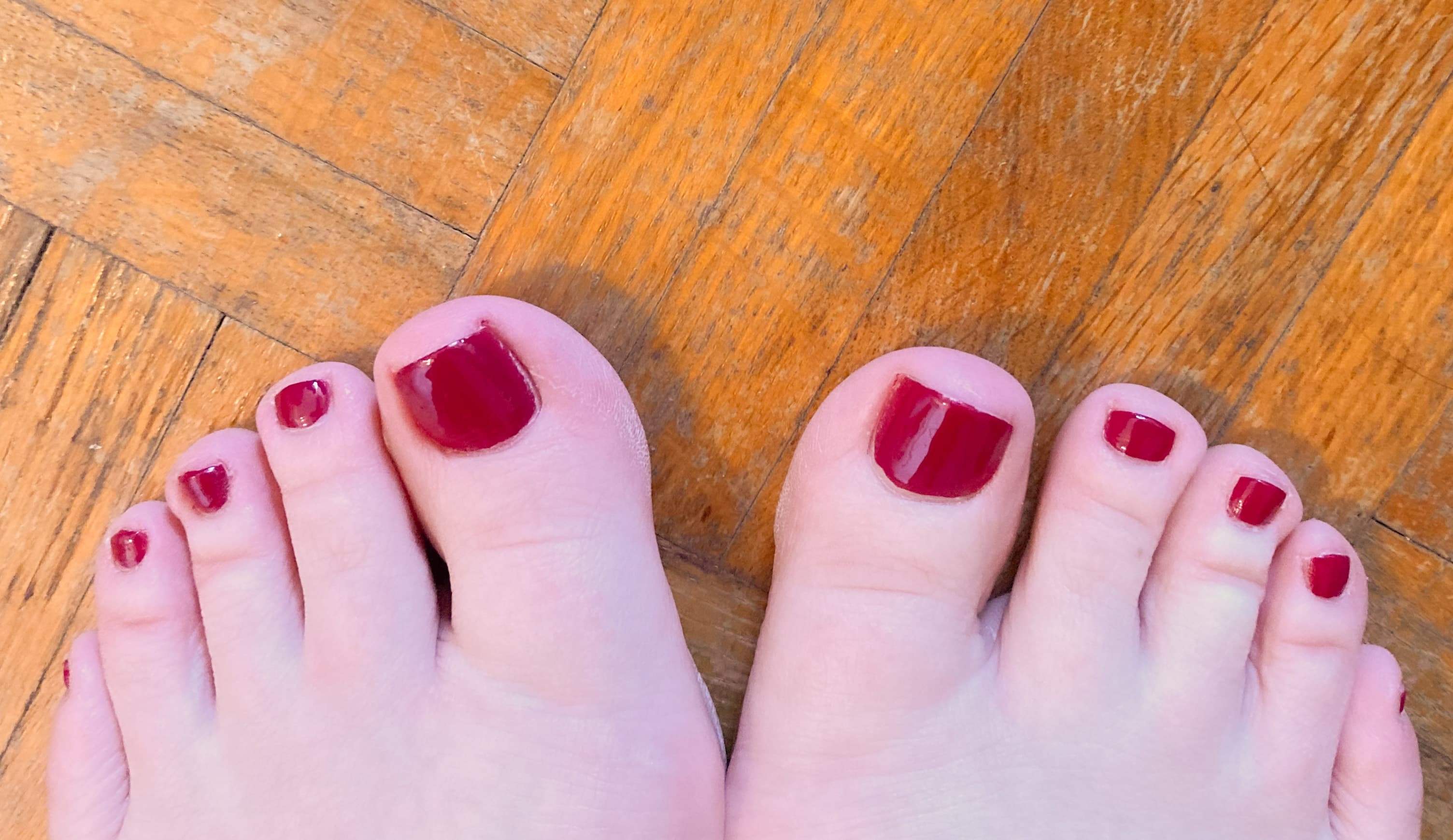 Lateral Malleoli banner image