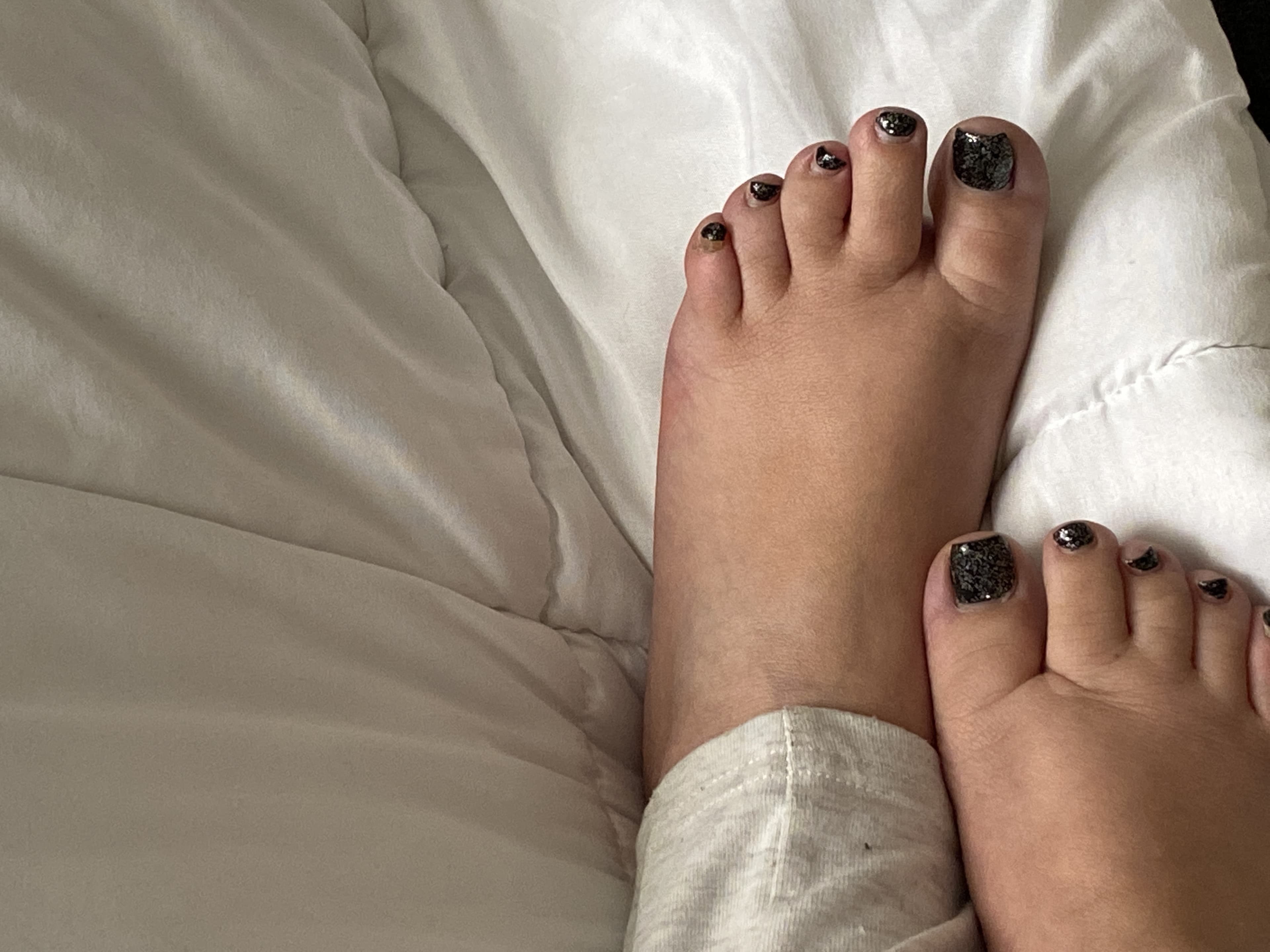 Fat Feet banner image