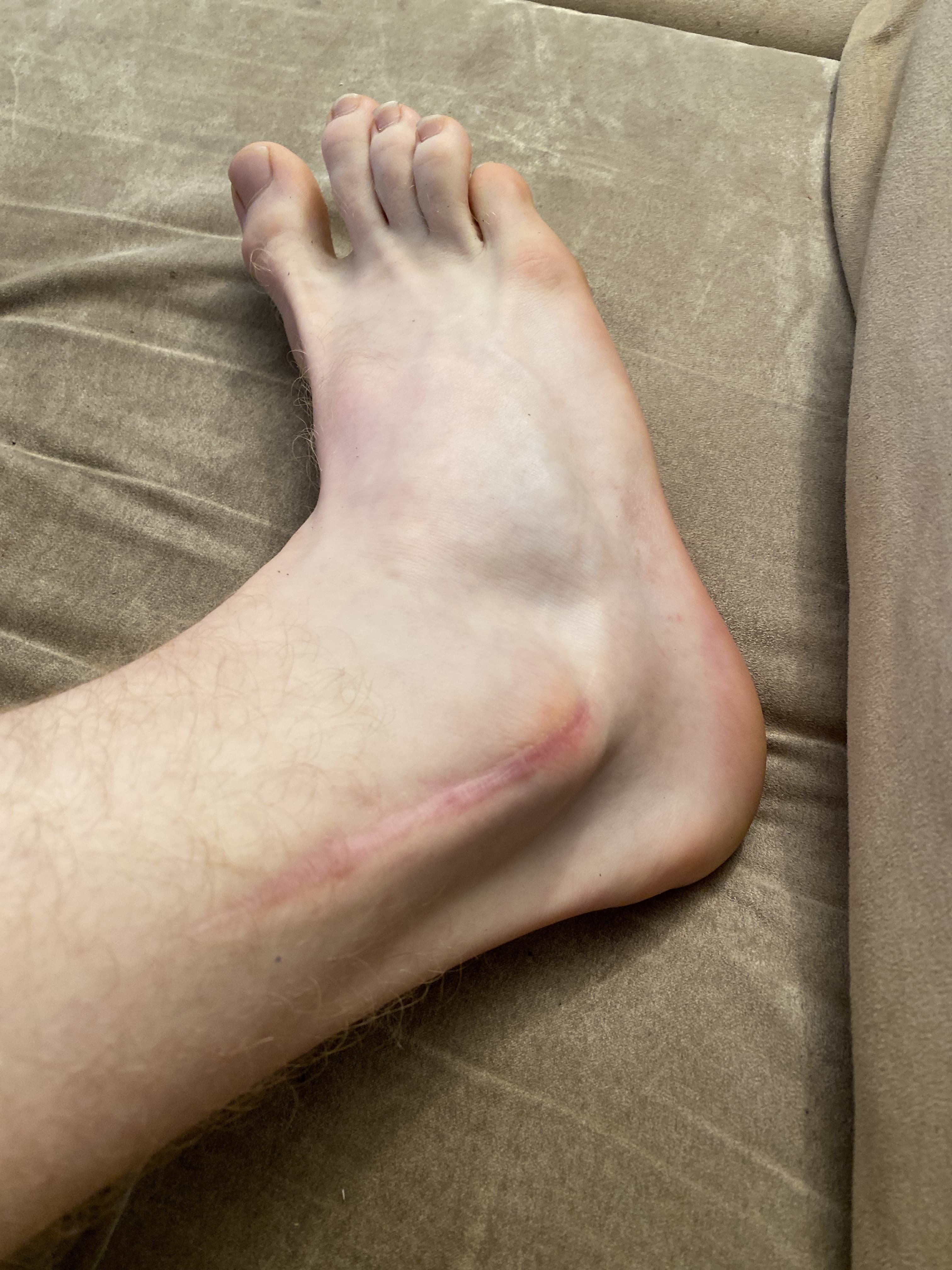 FeetWithScares banner image