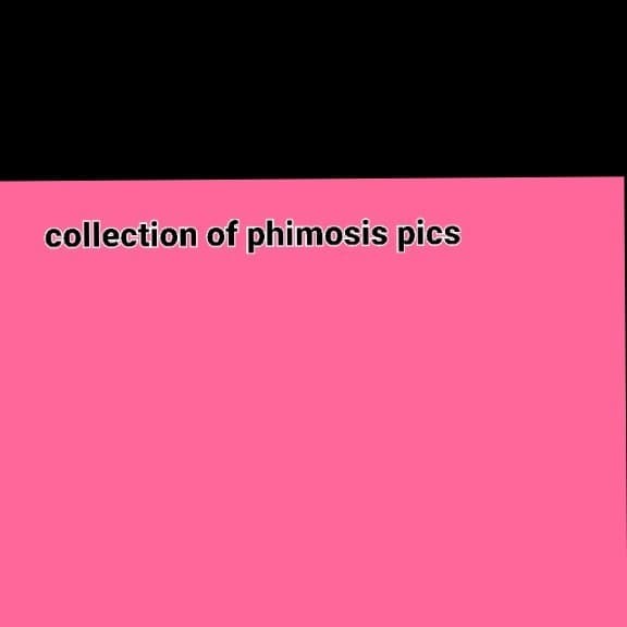 元祖包茎画像集 collection of Phimosis pics banner image