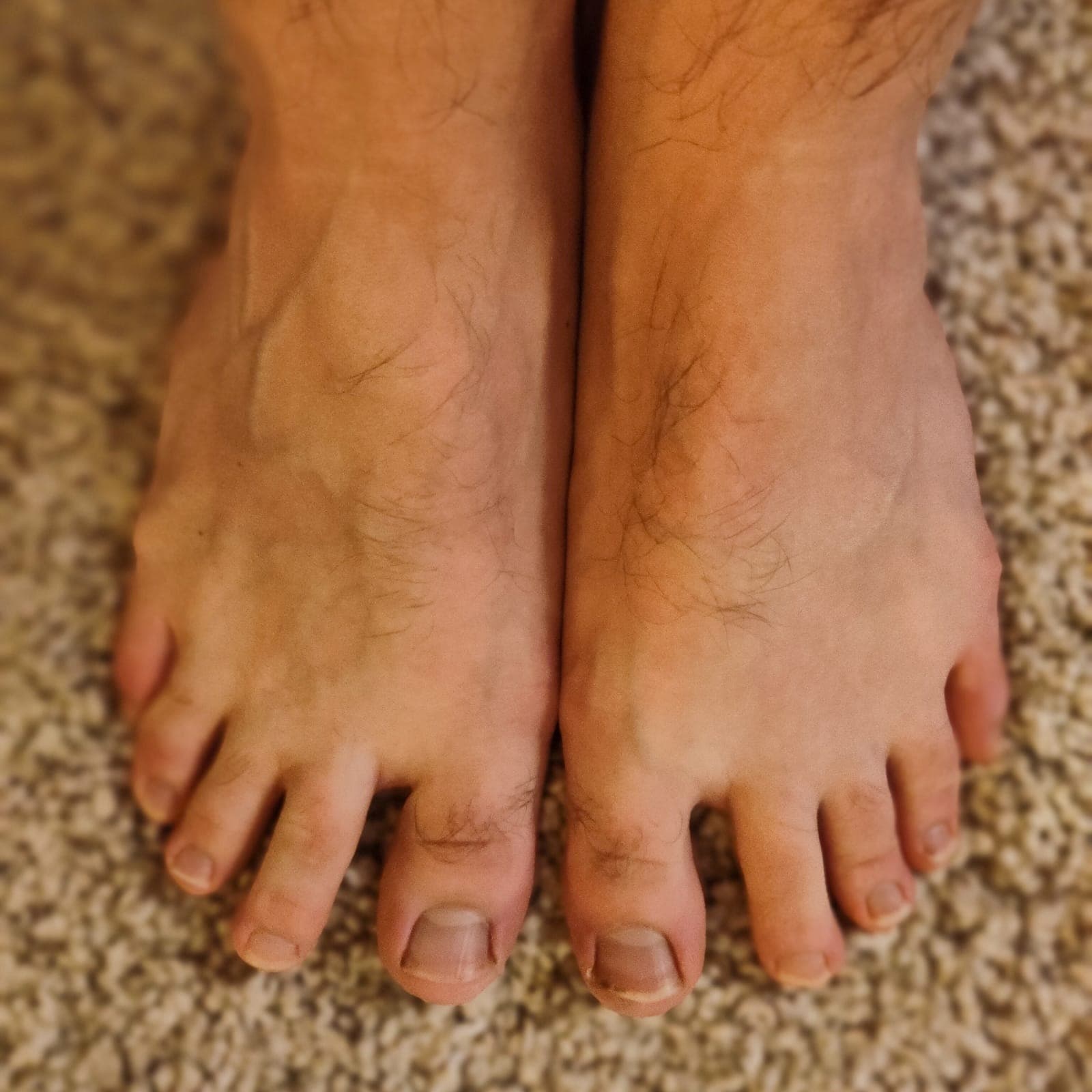 Basics Feet banner image
