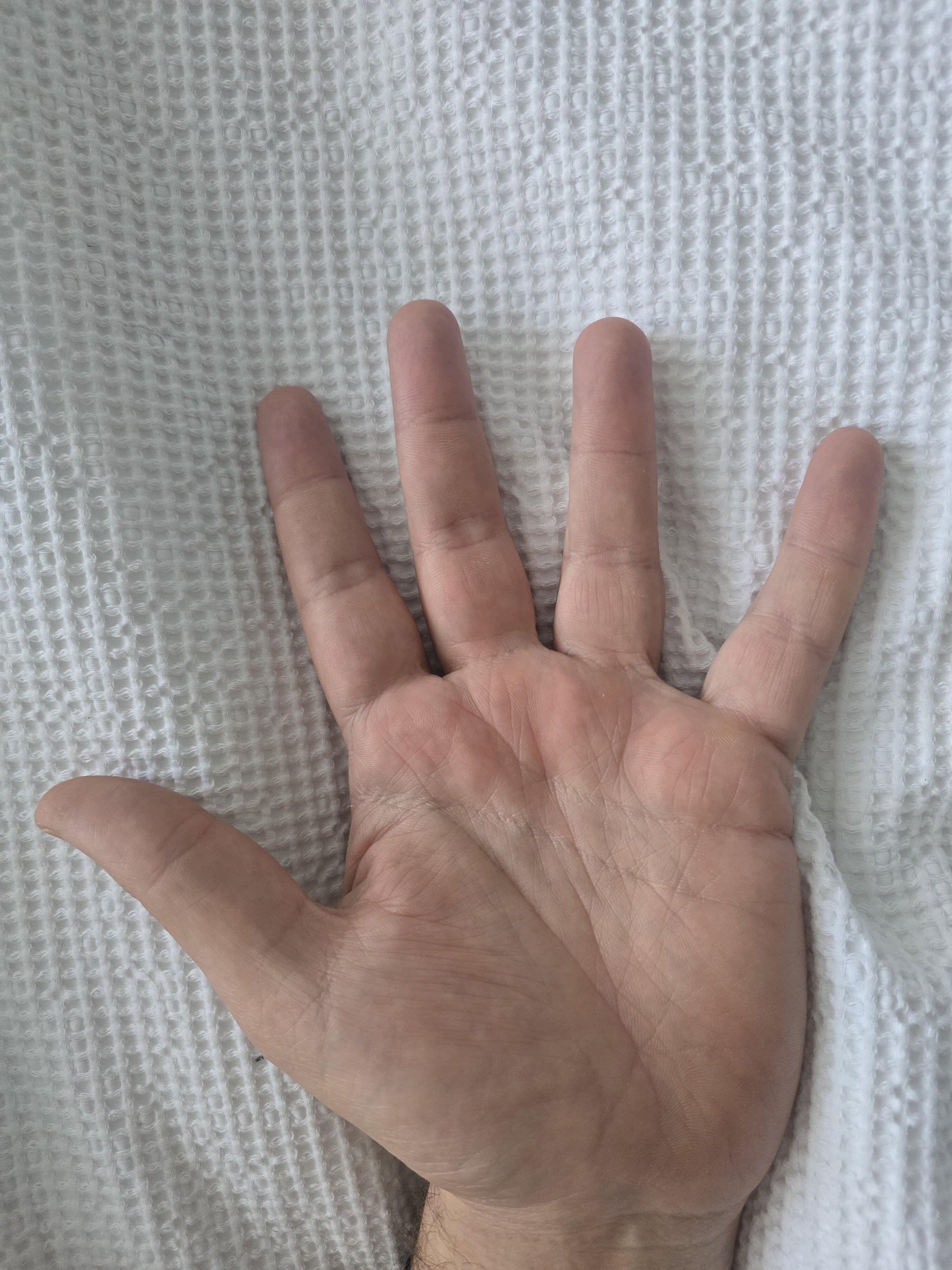 Handzilla XXL ๐ banner image