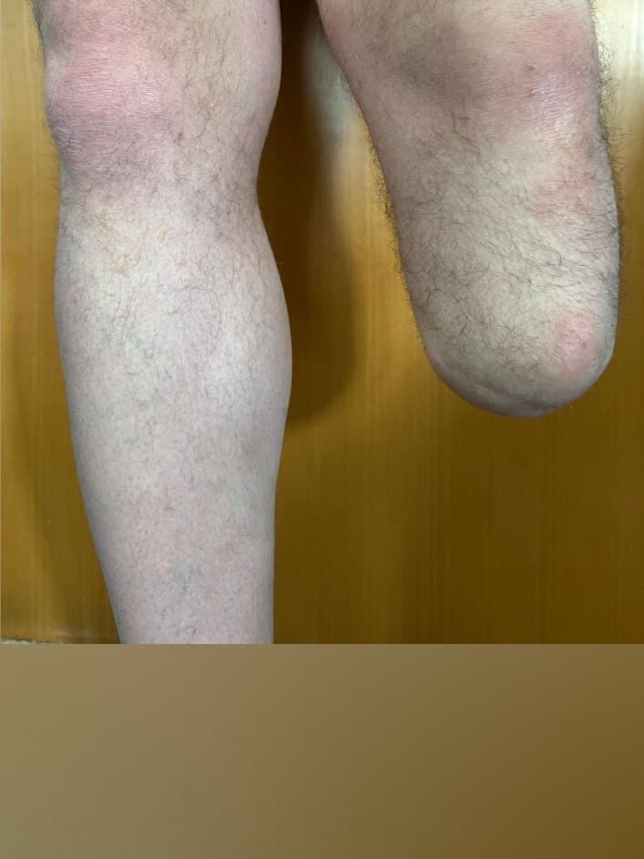 onestumponefoot banner image