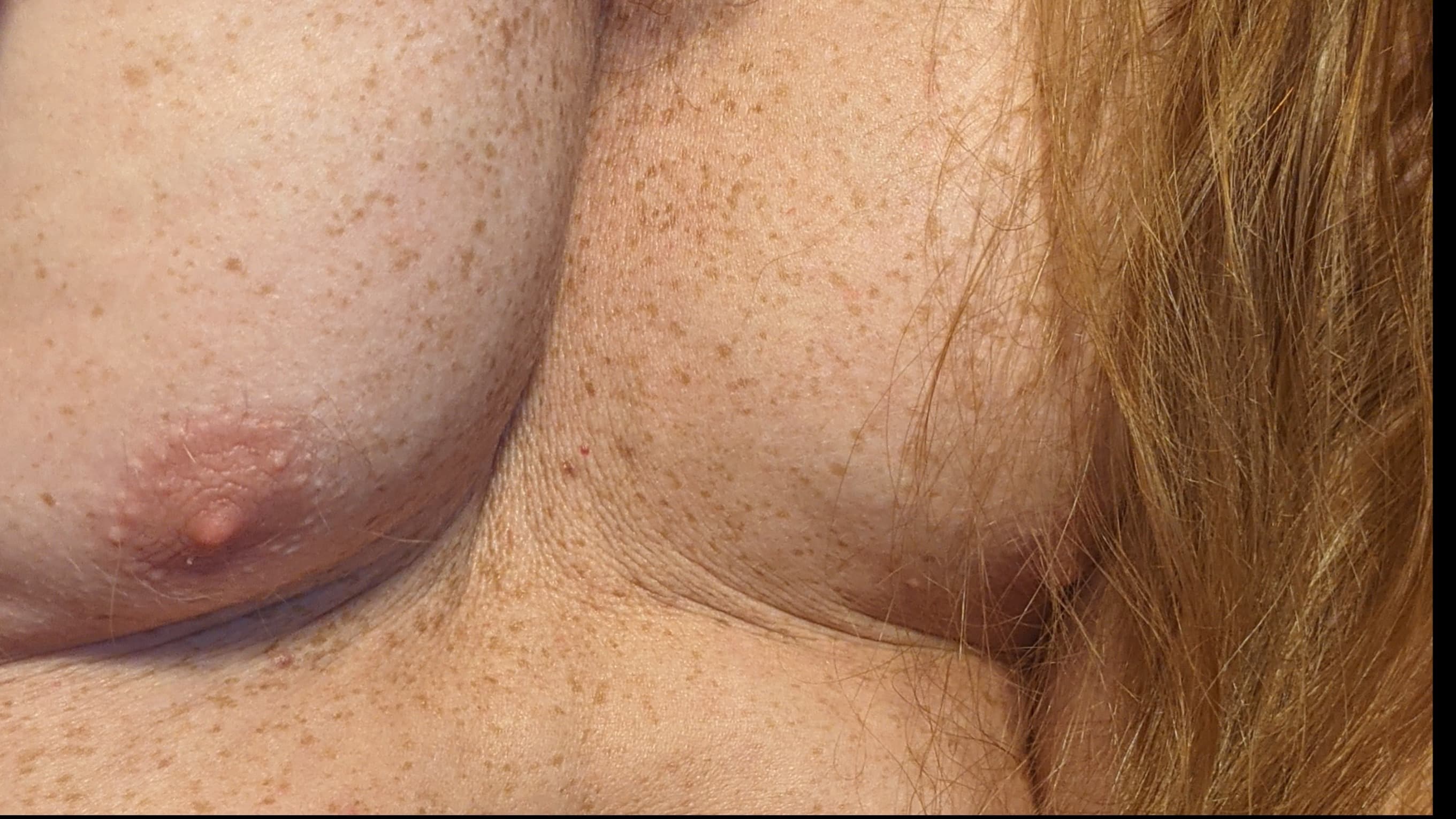 Medullan banner image