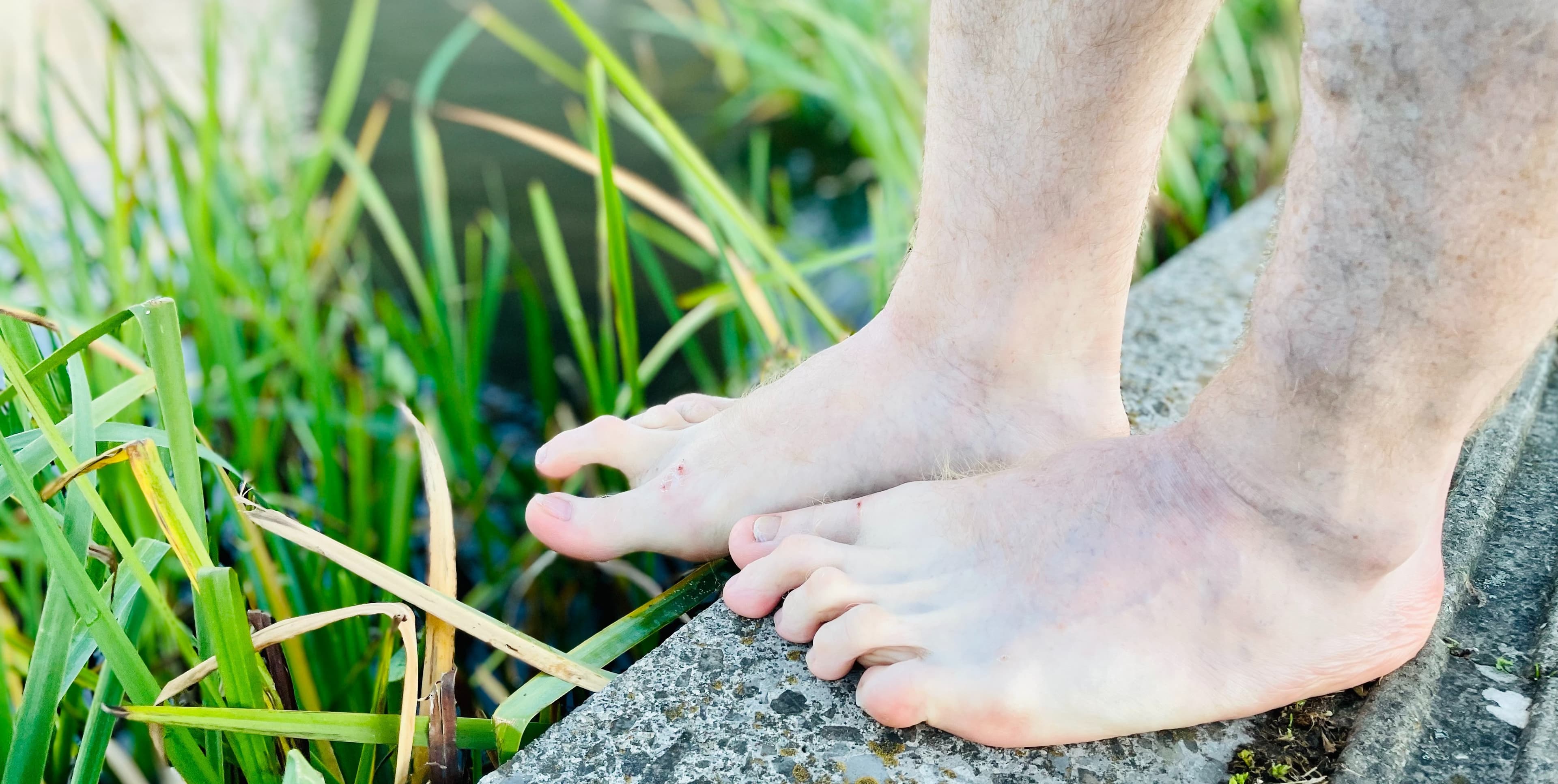 MySmellyUglyFeet banner image