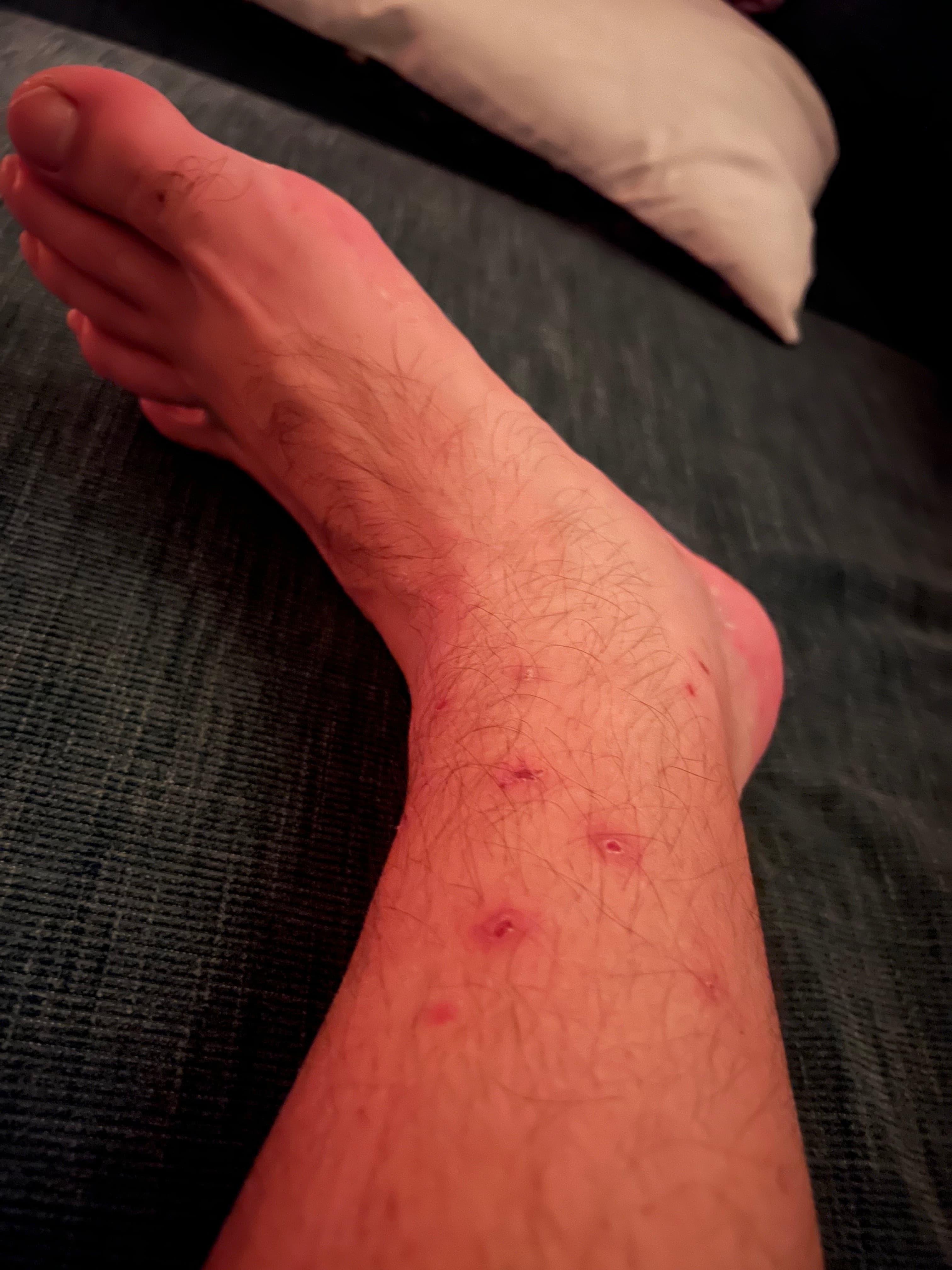 Feet stripper banner image