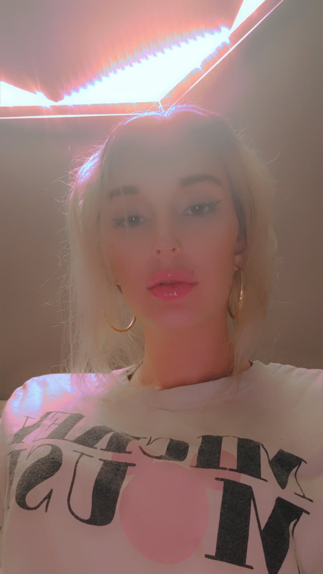 Slimcarmella banner image