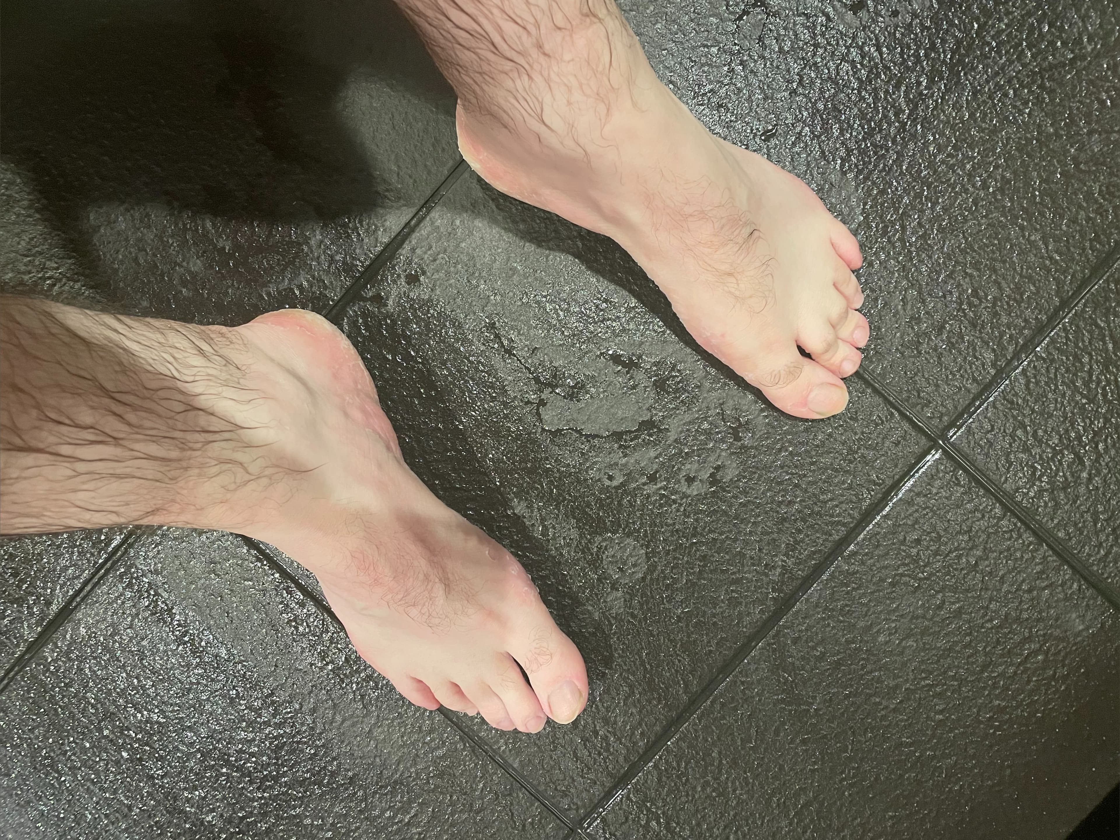 toe spreader boy banner image