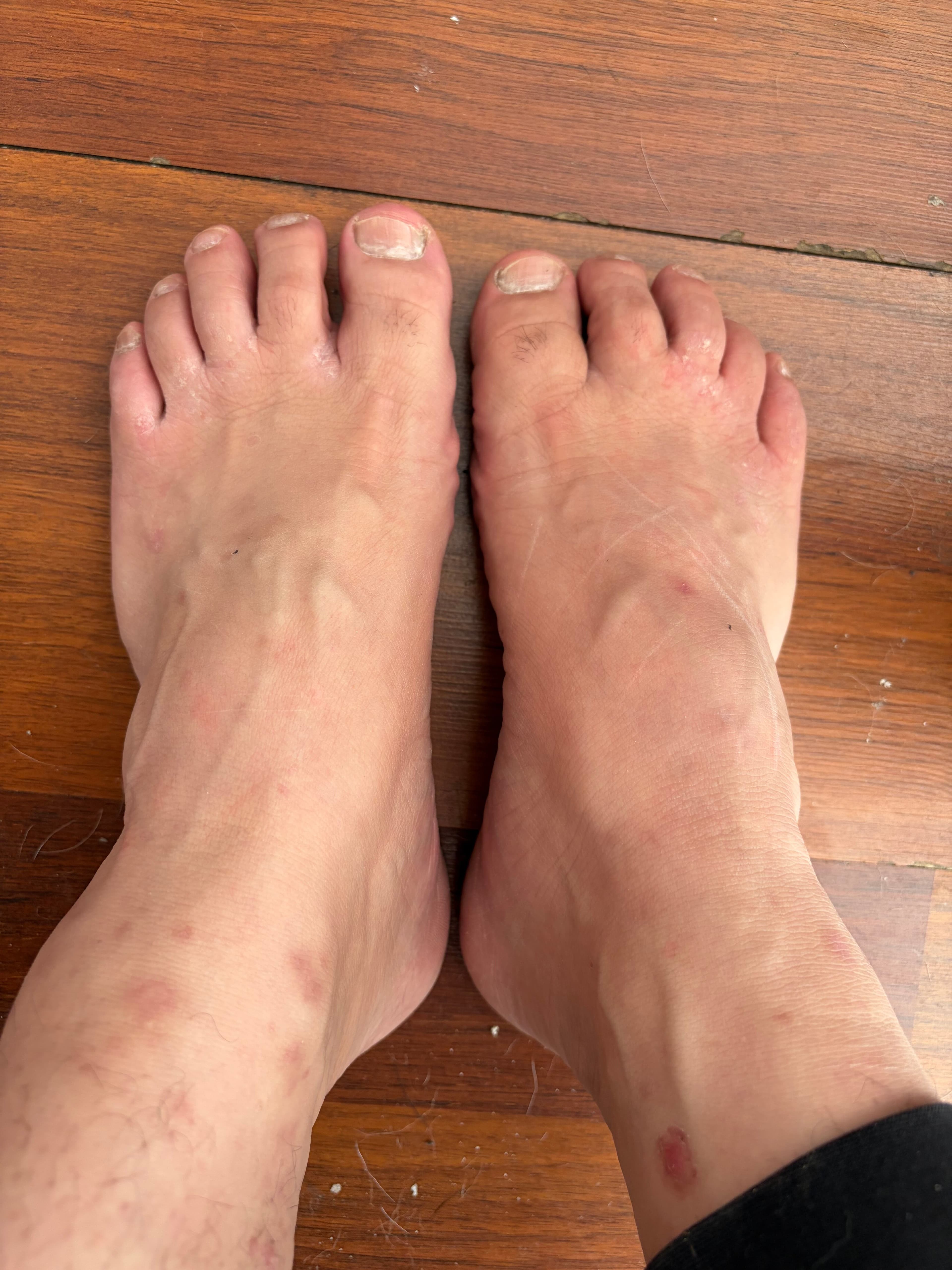 My Feets banner image
