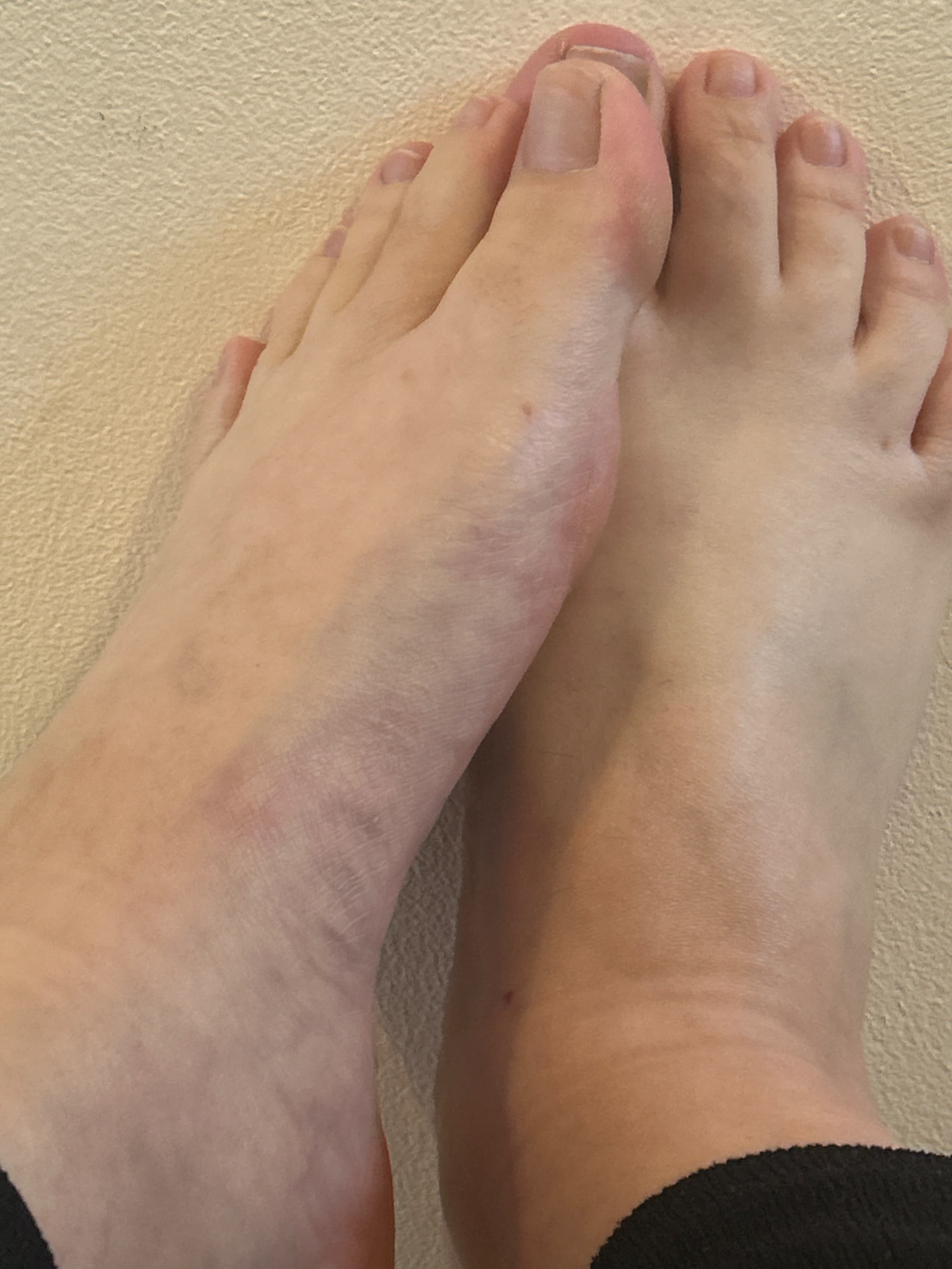 Feeling hands and feet banner image