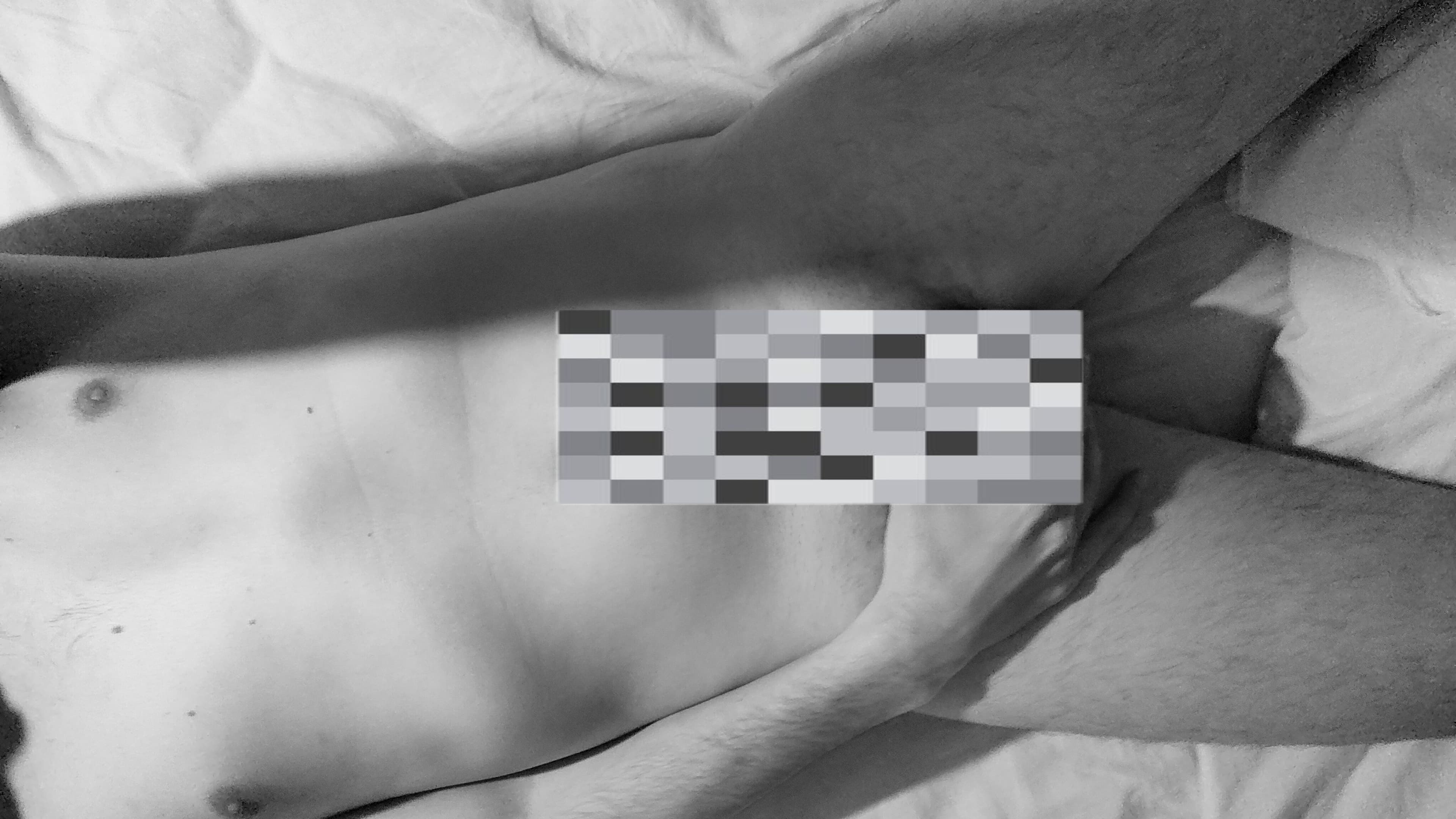 VitiligoBoy banner image