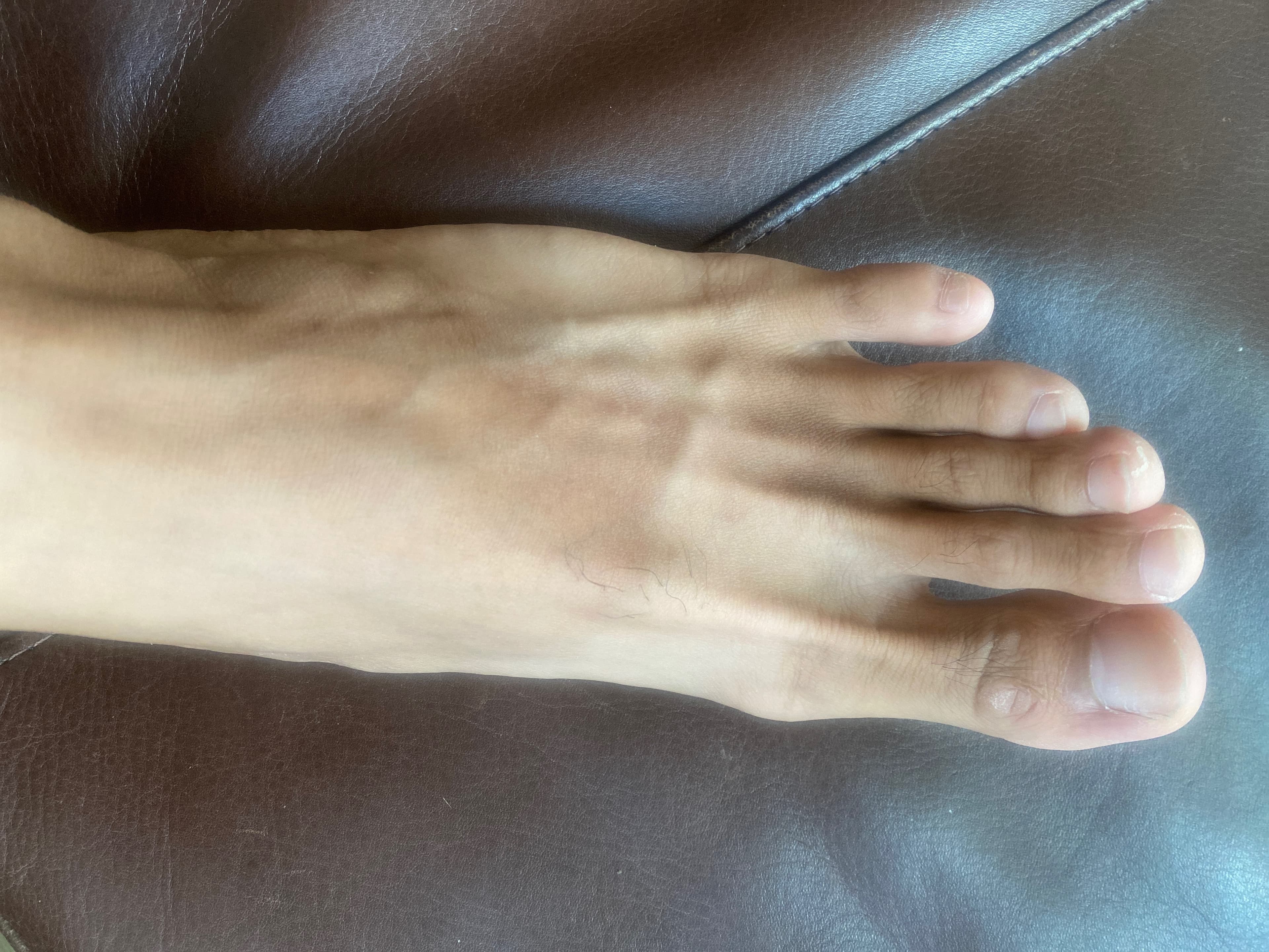 No Small Feet banner image